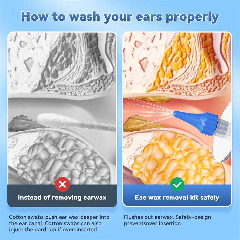 Ear Wax Removal Manual Ear Cle - Urban Farming System reseña y precio
