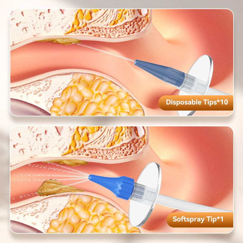 Ear Wax Removal Manual Ear Irr - Urban Farming System reseña y precio